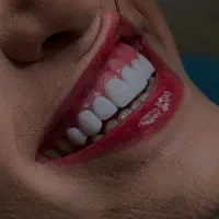 لبخند هالیوودی فقط 6 میلیون تومان / شهریار