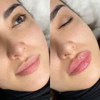 جشنواره تخفیفی کلینیک زیبایی الینور