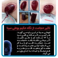 حجامت/بادکش/زالو/ناف گیر/ماسـاژدرمنــزل شـما|خدمات آرایشگری و زیبایی|کرمانشاه, |دیوار