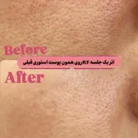 خدمات زیبایی پوست و مو در مطب دکتر شریفی|خدمات آرایشگری و زیبایی|فولادشهر, B5|دیوار