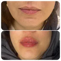 ۷۰درصد تخفیف بلک فرایدی