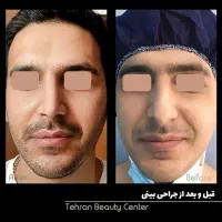 کاشت مو، کاشت ابرو، بلفارو، عمل بینی، رفع غبغب|خدمات آرایشگری و زیبایی|کرج, فاز ۱ مهرشهر|دیوار