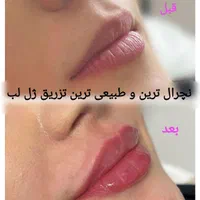 جشنواره تخفیفات کلینیک پوست همراه با هدیه|خدمات آرایشگری و زیبایی|مشهد, کوه سنگی|دیوار