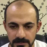 کاشت مو با جدید ترین روش بدون جراحی و درد|خدمات آرایشگری و زیبایی|اردبیل, |دیوار