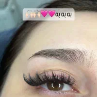 کاشت مژه هیدن لاکچری