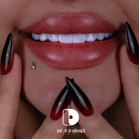 کامپوزیت/لمینت/دندانپزشکی|خدمات آرایشگری و زیبایی|مشهد, کوثر|دیوار