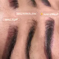 ریموو و میکروبلیدینگ ابرو|خدمات آرایشگری و زیبایی|رشت, دیلمان|دیوار