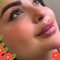 تزریق بوتاکس وفیلر