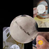 خدمات اصلاح درماپلنینگ