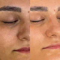 پاکسازی پوست وفیشیال|خدمات آرایشگری و زیبایی|مسجد سلیمان, |دیوار