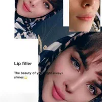 جشنواره تزریق ژل و بوتاکس و آموزش|خدمات آرایشگری و زیبایی|اصفهان, بهار آزادی|دیوار