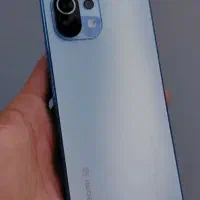 شیاومی mi11 5G