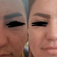 پوستت را مثل آینه کن