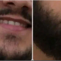 اپشن رویش