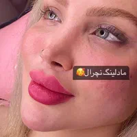 تزریق (ژل،بوتاکس،نخ)قیمت مناسب|خدمات آرایشگری و زیبایی|ملارد, |دیوار