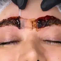 اموزش صفرتاصد ریمووتخصصی صورت وبدن