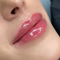 مطب زیبایی جشنواره بوتاکس رایگان