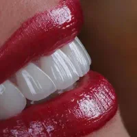 دندانپزشکی بیمه های تکمیلی دانا و معلم و ملت