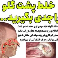 خلت پشت حلق داری