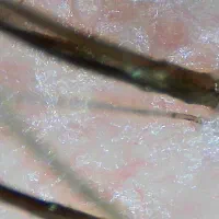 پاکسازی کف سر تخصصی / کراتین و پروتئین|خدمات آرایشگری و زیبایی|اصفهان, کوی ولی عصر|دیوار