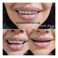 دندانسازی(بلوارهدایت)دندان مصنوعی/دندان سازی|خدمات آرایشگری و زیبایی|مشهد, هدایت|دیوار