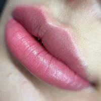 ترمیم و روشن‌سازی تیرگی لب،شیدینگ لب با تخفیف ویژه