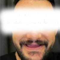 ساخت تخصصی دندان مصنوعی در استان قم|خدمات زیبایی و سلامت|قم, باغ شازده|دیوار