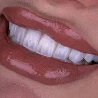خدمات دندانپزشکی