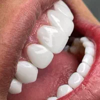 دندانپزشکی و دندانسازی