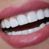 تخصص ما زیبایی دندان هاست|خدمات آرایشگری و زیبایی|انار, |دیوار