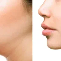 دستگاه از بین برنده غب غب انگلیسی|تجهیزات ورزشی|تهران, نیاوران|دیوار