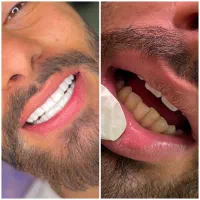 دندانپزشکی وزیبایی|خدمات آرایشگری و زیبایی|تهران, تهران پارس|دیوار