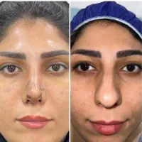 عمل بینی ترمیمی/گوشتی/پلک/غبغب/کاشت ابرو