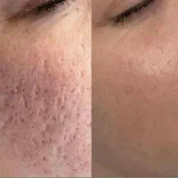 مشاور تخصصی پوست و مو و زیبایی به صورت رایگان.