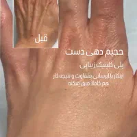 تزریقات زیبایی