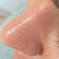 فشیال تخصصی+ اصلاح با بند + درماپلینگ + ابرو  ۳۵۰|خدمات آرایشگری و زیبایی|زاهدان, |دیوار