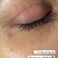 انجام عمل جراحی توسط فوق تخصص جراحی پلاستیک|خدمات آرایشگری و زیبایی|تهران, بلوار کشاورز|دیوار
