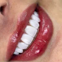 دندانپزشکی تخصصی تهرانپارس|خدمات زیبایی و سلامت|تهران, خاک سفید|دیوار