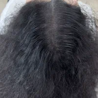 میکرواسکالپ سر/شیدینگ لب/رفع کبودی لب/بنمژه|خدمات آرایشگری و زیبایی|شیراز, معالی‌آباد|دیوار
