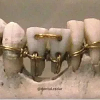 بازاریاب دندانسازی با پورسانت بالا