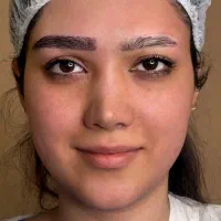 جشنواره تخفیفی کاشت ابرو