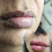 مرکززیبایی و لیزر آکو|خدمات آرایشگری و زیبایی|اندیمشک, |دیوار