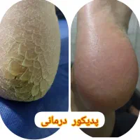 پدیکور درمانی آقایان و بانوان|خدمات آرایشگری و زیبایی|قم, دورشهر|دیوار