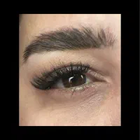 کاشت مژه (کاشت هیدن)
