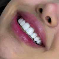 تخفیف ویژه کامپوزیت یلدایی|خدمات آرایشگری و زیبایی|شیراز, قصرالدشت|دیوار