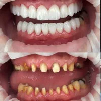 زیبایی دندان و ترمیم و درمان تخصصی|خدمات آرایشگری و زیبایی|ملارد, |دیوار