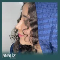 عمل بینی/پلک/غبغب/بوتاکس/پیکرتراشی|خدمات آرایشگری و زیبایی|یاسوج, |دیوار