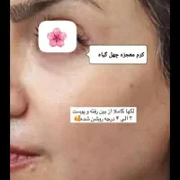 کرم معجزه 43ترکیبه کلاژن گیاهی سفید کنندگی قوی