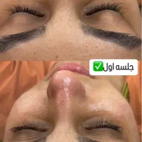 فیشال تخصصی خانم ها واقایان تحت نظر پزشک