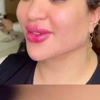 ژل/بوتاکس/چربی/مزوژل/وآموزش گروهی وخصوصی|خدمات آرایشگری و زیبایی|اهواز, گلستان|دیوار